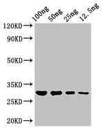Salmonella typhi hupB Polyclonal Antibody