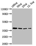 Epstein Barr Virus BZLF2 Antibody in Western Blot (WB)