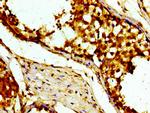 USP10 Antibody in Immunohistochemistry (Paraffin) (IHC (P))