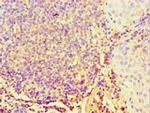 STARD3 Antibody in Immunohistochemistry (Paraffin) (IHC (P))