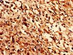 GLE1 Antibody in Immunohistochemistry (IHC)