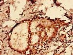 GLE1 Antibody in Immunohistochemistry (IHC)