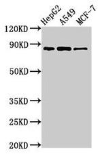 GLE1 Antibody in Western Blot (WB)