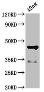 Desulfotalea psychrophila DNA ligase Polyclonal Antibody