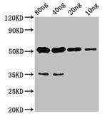CYP26B1 Polyclonal Antibody
