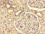 PREX2 Antibody in Immunohistochemistry (Paraffin) (IHC (P))