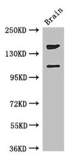 PREX2 Antibody in Western Blot (WB)