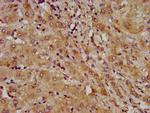 LAPTM4B Antibody in Immunohistochemistry (Paraffin) (IHC (P))