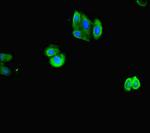 ACTL9 Antibody in Immunocytochemistry (ICC/IF)