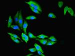 CMBL Polyclonal Antibody