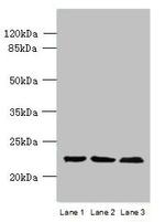 WDYHV1 Polyclonal Antibody