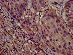CLPTM1L Antibody in Immunohistochemistry (Paraffin) (IHC (P))