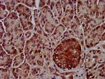 CLPTM1L Antibody in Immunohistochemistry (Paraffin) (IHC (P))
