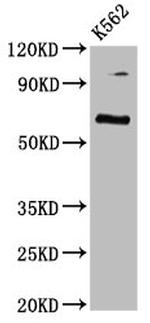 CLPTM1L Antibody in Western Blot (WB)