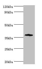 CD200R Antibody in Western Blot (WB)