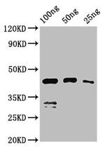 Chicken Anemia Virus VP1 Polyclonal Antibody