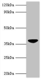 Chicken Anemia Virus VP3 Antibody in Western Blot (WB)