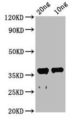 Acetylcholinesterase Polyclonal Antibody