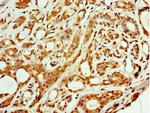 ARFGAP3 Polyclonal Antibody