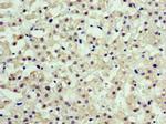 ARFGAP3 Antibody in Immunohistochemistry (Paraffin) (IHC (P))