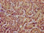 TES Antibody in Immunohistochemistry (Paraffin) (IHC (P))