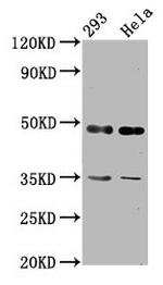 TES Antibody in Western Blot (WB)