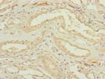 CEP83 Antibody in Immunohistochemistry (Paraffin) (IHC (P))