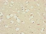 CEP83 Antibody in Immunohistochemistry (Paraffin) (IHC (P))