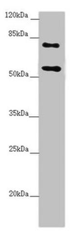 CEP83 Antibody in Western Blot (WB)