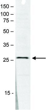 SAP30 Polyclonal Antibody