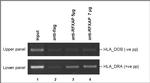 RFXAP Antibody in ChIP Assay (ChIP)