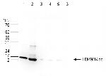 H3K9acK14ac Antibody in Western Blot (WB)