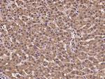 ACAT2 Antibody in Immunohistochemistry (Paraffin) (IHC (P))