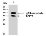 ACAT2 Antibody in Immunoprecipitation (IP)