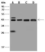 ACAT2 Antibody in Western Blot (WB)