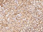 ACOT1 Antibody in Immunohistochemistry (Paraffin) (IHC (P))