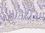Alpha-Smooth Muscle Actin Antibody in Immunohistochemistry (Paraffin) (IHC (P))