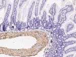 Alpha-Smooth Muscle Actin Antibody in Immunohistochemistry (Paraffin) (IHC (P))