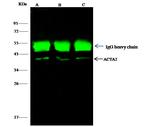 Alpha-Smooth Muscle Actin Antibody in Immunoprecipitation (IP)