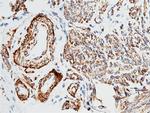 Alpha-Smooth Muscle Actin Antibody in Immunohistochemistry (Paraffin) (IHC (P))