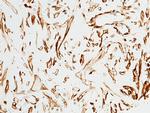 Alpha-Smooth Muscle Actin Antibody in Immunohistochemistry (Paraffin) (IHC (P))