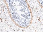 Alpha-Smooth Muscle Actin Antibody in Immunohistochemistry (Paraffin) (IHC (P))