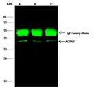 Alpha-Smooth Muscle Actin Antibody in Immunoprecipitation (IP)