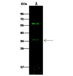 beta-3 Adrenergic Receptor Polyclonal Antibody