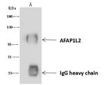 AFAP1L2 Antibody in Immunoprecipitation (IP)