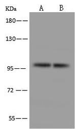 AGO2 Polyclonal Antibody