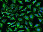 EMAP II Polyclonal Antibody
