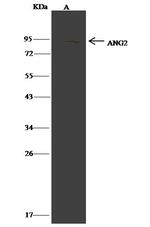 Angiopoietin 2 Antibody in Immunoprecipitation (IP)