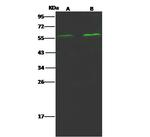 Angiopoietin 2 Antibody in Western Blot (WB)