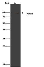 Angiopoietin 2 Antibody in Immunoprecipitation (IP)